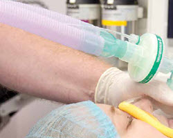 Intersurgical anaesthetic breathing systems