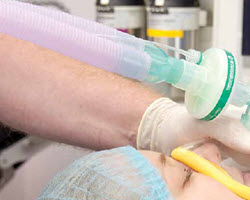Intersurgical anaesthetic breathing systems