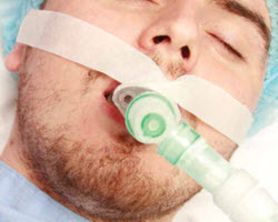 Intersurgical patient connections