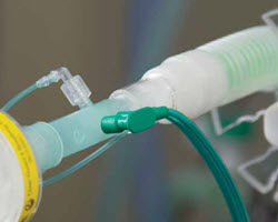 Intersurgical spirometry range