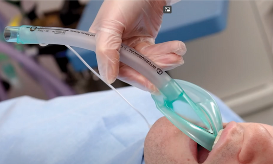 The Intersurgical laryngeal mask range