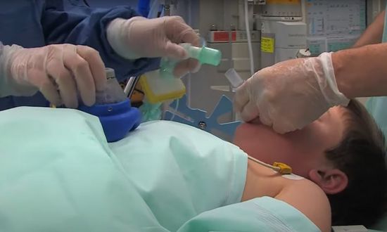 Use of the i-gel® supraglottic airway from Intersurgical in paediatric surgery